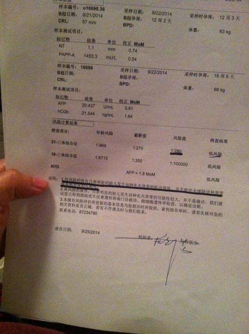 dna亲子鉴定多少钱啊
