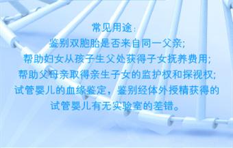 dna亲子关系鉴定